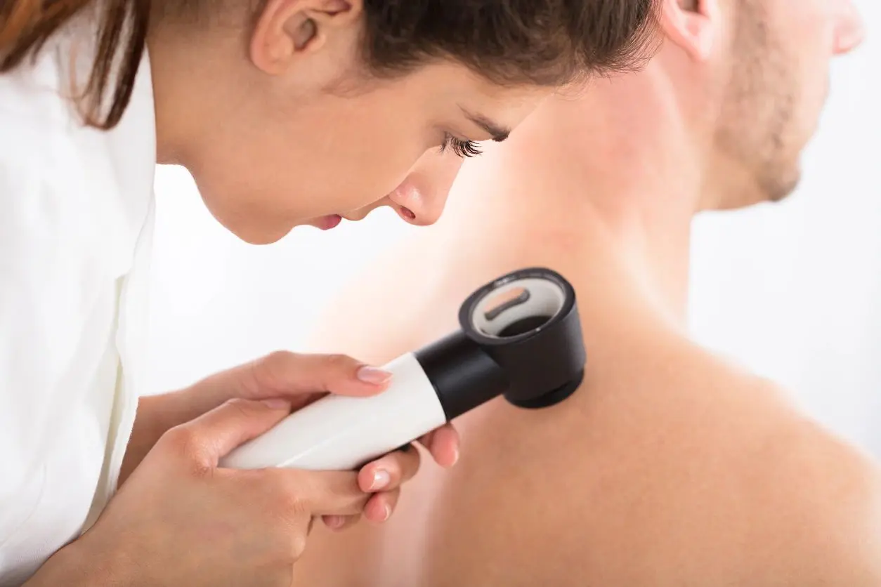 Doctor Examining Man's Shoulder With Dermatoscope