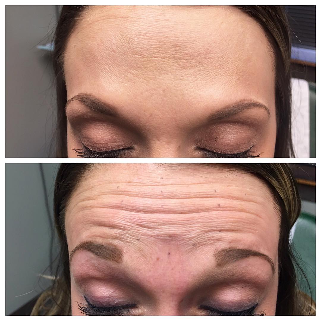 Before & After Archive - Skin & Allergy Center